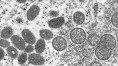 Photo of Second Case Of Monkeypox Confirmed In Missouri