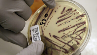 Photo of Salmonella outbreak in parts of Oklahoma