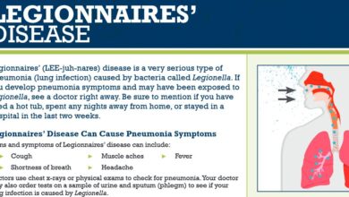 Photo of Three cases of Legionnaires’ disease reported at Cassville resort